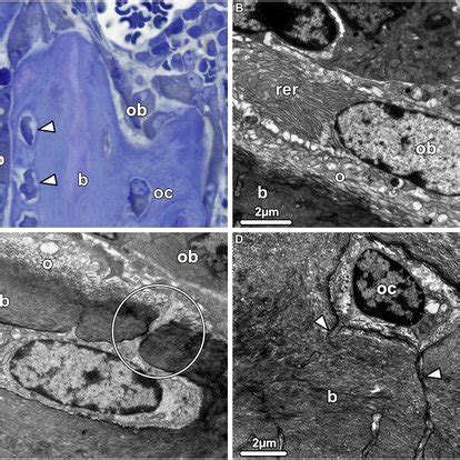 Differentiation of the osteoblasts to osteocytes. (A) Light Microscopy... | Download Scientific ...