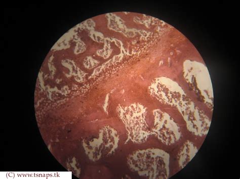 Histology Slides Database: spongy bone histology slide