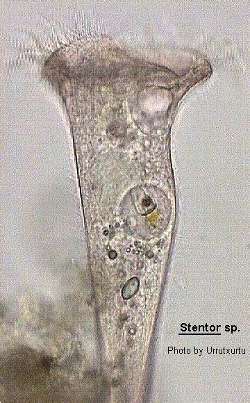 Stentor Morphology