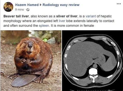 Beaver tail liver