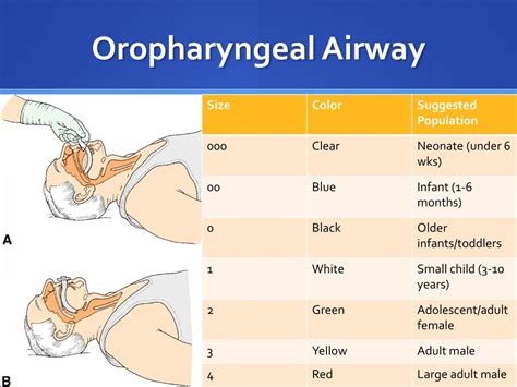 Oropharyngeal Airway Sizing