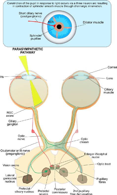 Figure 3 from Eyeing up the Future of the Pupillary Light Reflex in Neurodiagnostics | Semantic ...