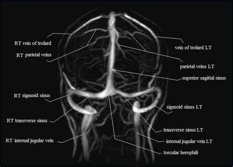 Pin on neuro