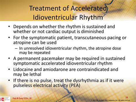 Idioventricular rhythm,what to know?