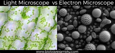 Difference between Light Microscope and Electron Microscope (Light Microscope vs Electron ...