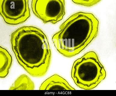 Anthrax electron microscope image Stock Photo - Alamy