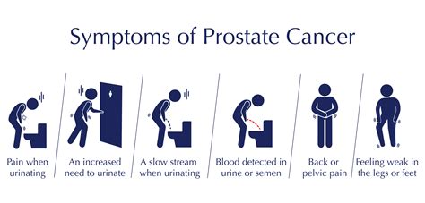 Prostate Cancer Symptoms