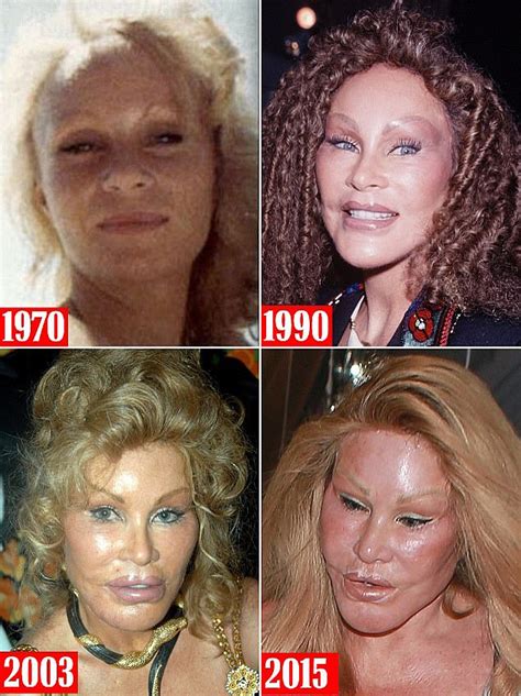 The celebrities who have denied ever having plastic surgery | Daily ...