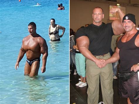 The Weird World of Synthol Bodybuilders