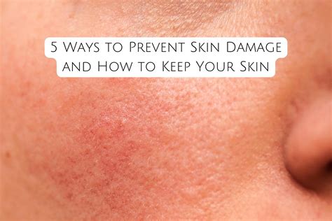 5 Ways to Prevent Skin Damage and How to Keep Your Skin - Kiwla