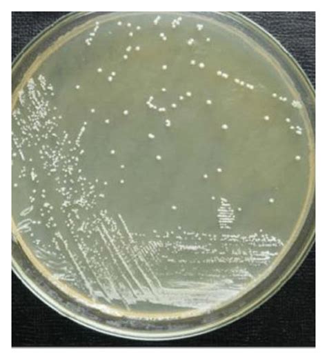 Conform plaster Operation possible lactobacillus colony morphology rod Few U.S. dollar