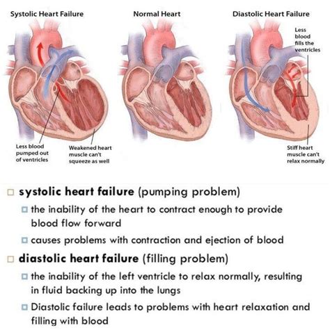 College Nursing, Nursing School Notes, Nursing Study, Nursing Tips ...