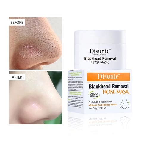 Remove Blackheads And Whiteheads Nose Mask Salicylic Acid Vs Blackheads ...