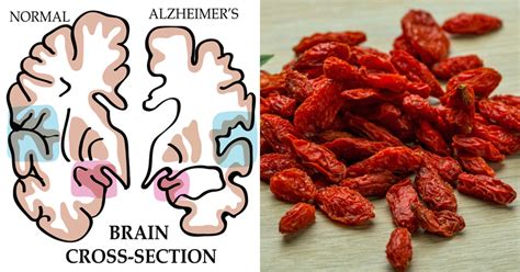 Berberine Benefits: Diabetes Treatment, Cardiovascular Health & More