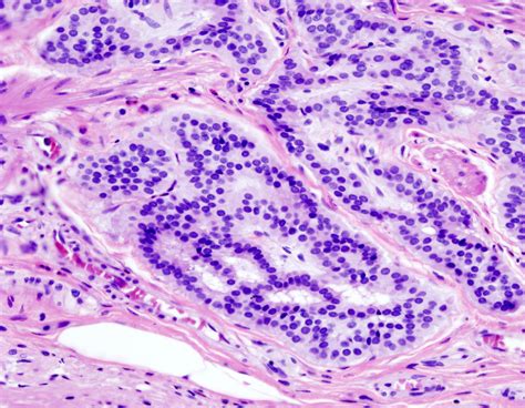 What is Hematoxylin & Eosin Stain ? - Aladdin Creations