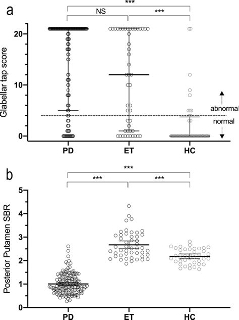 Glabellar tap score and specific binding ratio of the PD, ET and HC... | Download Scientific Diagram