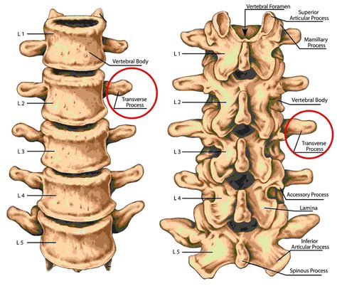 Transverse Process Fractures. A Broken Spine From Crashing