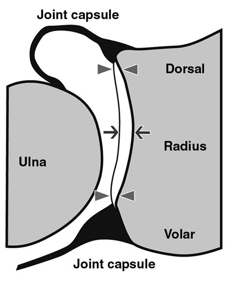 Morphology of the Distal Radioulnar Joint: Cadaveric Study With MRI and ...