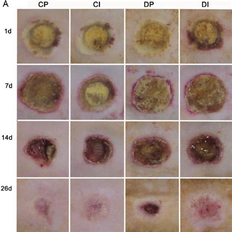 Images and analysis of wound area and reepithelialization. The wound... | Download Scientific ...