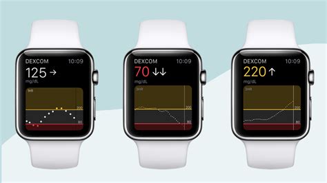 Smartwatches: Monitoring Diabetes from Your Wrist