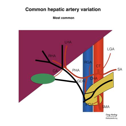 Left Gastric Artery Anatomy