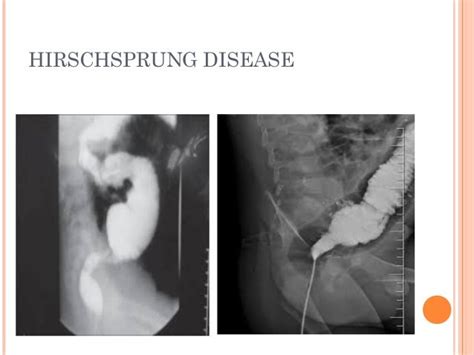 Gi radiology mbbs final