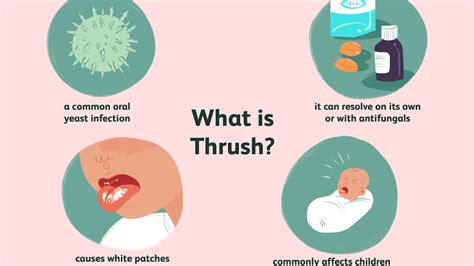 Images Of Yeast Infection In Mouth - Yeast infection of the mouth images. - Mambu Png