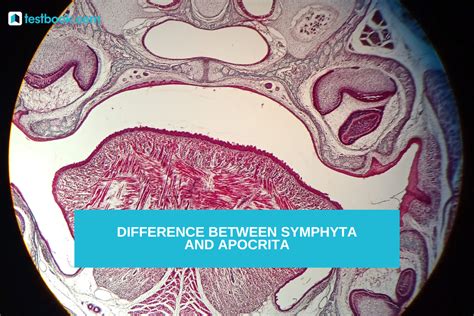 Difference Between Symphyta and Apocrita: Taxonomic Variances