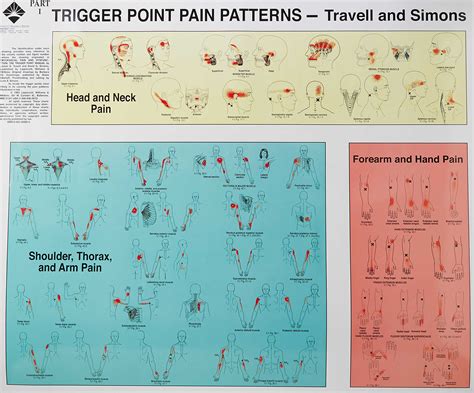 Myofascial pain syndrome causes, symptoms, diagnosis, treatment & prognosis