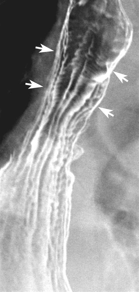 Feline Esophagus and Gastroesophageal Reflux | AJR