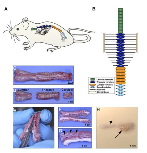 DRG extraction on day 8. A. Rat schematic illustrating the anatomical... | Download Scientific ...