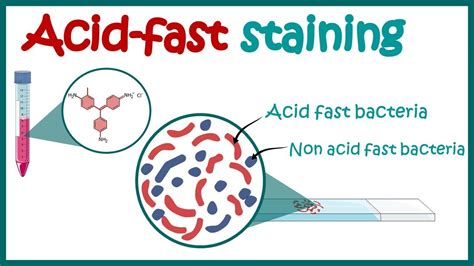 ACID FAST STAINING Acid Fast Organisms Bacterial Staining Technique 8040 | Hot Sex Picture