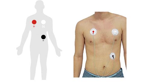 ECG electrode placement | Download Scientific Diagram