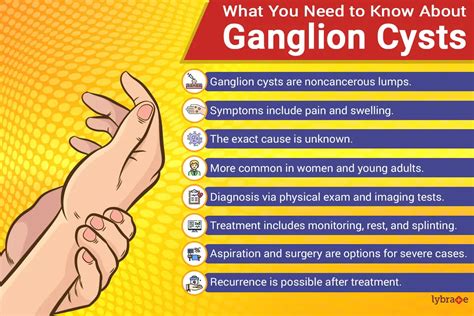 Understanding Ganglion Cysts: Causes, Symptoms, And Treatment - Ask The ...