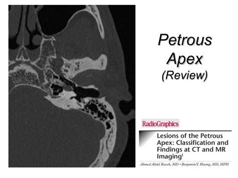 Petrous apex and skull base