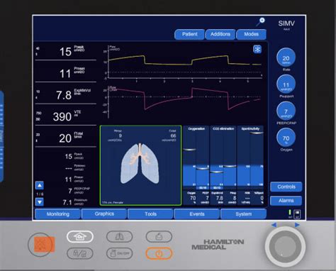 להיתמודד עם יועץ שכנוע hamilton ventilator לקצור בתדירות גבוהה תיאור עסקי