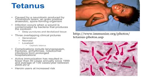 Tetanus - Epidemiology and Associated Complications - YouTube