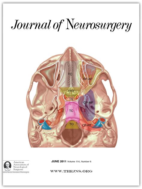 face publicitate stindard Abandon microscopic morphology and histology of the human meninges ...