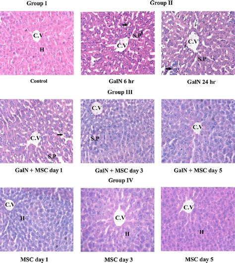 Histopathology of mice liver (H & E). Experimental protocol is... | Download Scientific Diagram