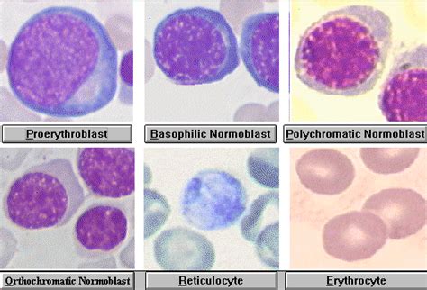 Pin by Evavelasquez on Guardado rápido | Hematology, Medical laboratory technician, Clinical ...