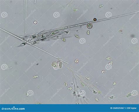 Diatoms, Algae Under Microscopic View, Phytoplankton, Fossils, Silica ...