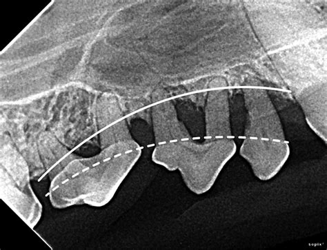 Interpreting Dental Radiographs | Clinician's Brief