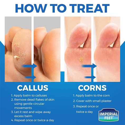 Foot Callus Remover for Feet Extra Strenght with Salicylic Acid - Corn Removers for Feet and ...