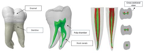 JCM | Free Full-Text | Root and Root Canal Configuration Characterization Using Microcomputed ...