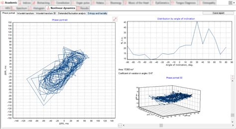 VedaPulse: New Nonlinear Dynamics software module release as part of the VedaPulse software ...