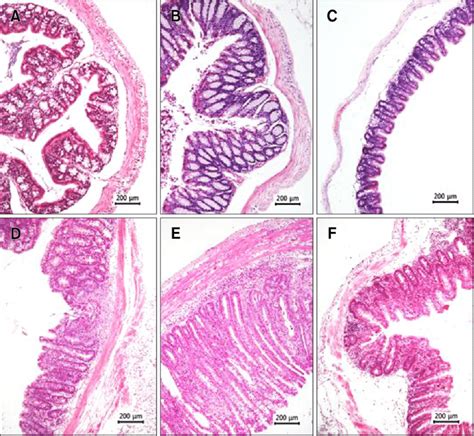 Colon Histology Slides Labeled