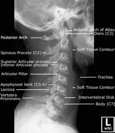 C-spine