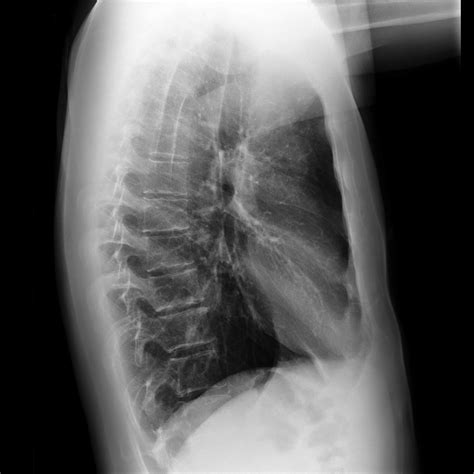 I'm Med Student: Diagnosis of previous case