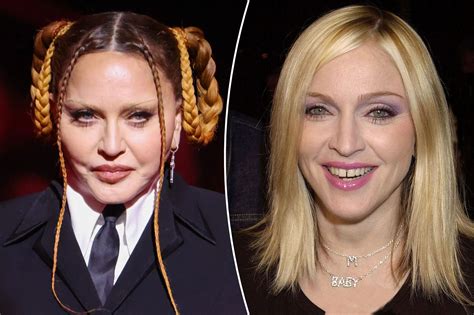 Madonna slams critics of her 'new face': 'Bow down, bitches!'