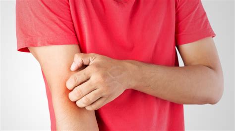 Banishing Eczema: Tips from Dermatologist Dr. Abhishek Malviya